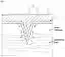 Fig. 05 - MICRONEEDLE WITH POROUS COATING LAYER, MANUFACTURING METHOD THEREOF AND MICRONEEDLE PATCH WITH THE SAME