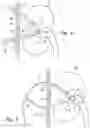 Fig. 04 - Catheter coupler and methods of exchanging catheters