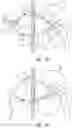 Fig. 09 - Catheter coupler and methods of exchanging catheters