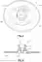 Fig. 03 - INFUSION DEVICE WITH RELEASABLE FLUID CONNECTOR