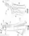 Fig. 41 - INFUSION DEVICE WITH RELEASABLE FLUID CONNECTOR