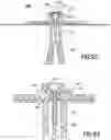 Fig. 44 - INFUSION DEVICE WITH RELEASABLE FLUID CONNECTOR