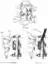 Fig. 12 - Systems and methods for deploying a paddle neurostimulation lead