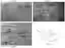 Fig. 07 - Methods and apparatuses for improving peripheral nerve function