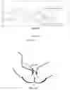 Fig. 20 - Methods and apparatuses for improving peripheral nerve function