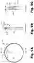 Fig. 10 - Methods and systems for treating osteoarthritis using an implantable stimulator
