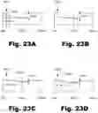 Fig. 24 - Methods and systems for treating osteoarthritis using an implantable stimulator