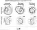 Fig. 12 - SYSTEM AND METHOD FOR BRAIN STIMULATION FOR IMPROVEMENT OF MOTOR SYMPTOMS IN PARKINSON'S DISEASE AND OTHER MOVEMENT DISORDERS