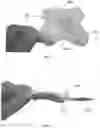 Fig. 05 - ULTRASOUND COUPLING PATCH WITH GEL CAPTURE FEATURE