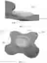 Fig. 08 - ULTRASOUND COUPLING PATCH WITH GEL CAPTURE FEATURE