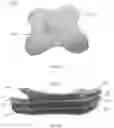 Fig. 09 - ULTRASOUND COUPLING PATCH WITH GEL CAPTURE FEATURE