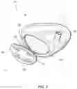 Fig. 03 - Method of forming golf club head assembly