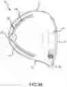 Fig. 26 - Golf club head having an adjustable weighting system