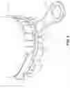 Fig. 04 - Dental guard and tray and method of forming such