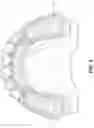Fig. 06 - Dental guard and tray and method of forming such