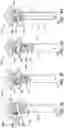 Fig. 05 - Desalter inlet distributor designs and methods