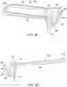 Fig. 24 - Safety filter snap fit system