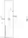 Fig. 02 - Bidirectional Split Flow Fluid Phase Separation System