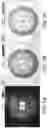 Fig. 06 - Fabrication of hydroxyapatite based hybrid sorbent media for removal of fluoride and other contaminants