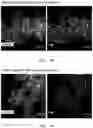 Fig. 05 - Method for preparing a carbon-supported, platinum-transition metal alloy nanoparticle fuel cell catalyst