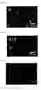 Fig. 03 - Nb-doped nickel oxide-zirconia composite catalyst and process for preparing the same