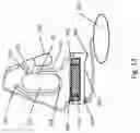 Fig. 17 - Fluidic centripetal device