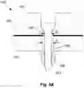 Fig. 04 - Mill liner removal system