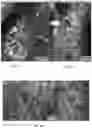 Fig. 10 - Methods of nanoscale directional wetting and uses thereof
