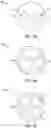 Fig. 04 - EDM MILLING ELECTRODE