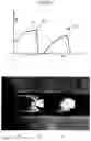 Fig. 04 - Laser processing system and laser processing method