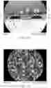 Fig. 07 - Method For Making An Apertured Web