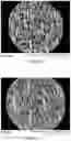 Fig. 08 - Method For Making An Apertured Web