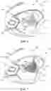 Fig. 05 - Modular molding systems and methods for making batting helmets