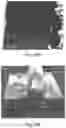 Fig. 27 - Nanostructure-reinforced composite articles and methods
