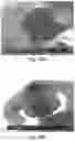 Fig. 35 - Nanostructure-reinforced composite articles and methods