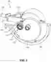 Fig. 04 - Electromechanical brake actuator