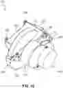 Fig. 11 - Electromechanical brake actuator