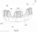 Fig. 11 - Motor and electric power steering device