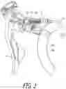 Fig. 03 - Hydraulic operating device