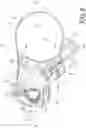Fig. 07 - Hydraulic operating device