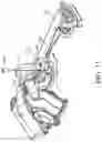 Fig. 12 - Bicycle rear derailleur