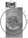 Fig. 14 - Smart Cap System And Methods Of Use