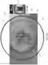 Fig. 17 - Smart Cap System And Methods Of Use