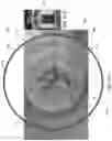 Fig. 18 - Smart Cap System And Methods Of Use
