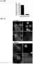 Fig. 10 - COMPOSITIONS AND METHODS FOR INHIBITING RETICULON 4