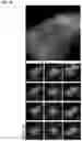 Fig. 12 - COMPOSITIONS AND METHODS FOR INHIBITING RETICULON 4