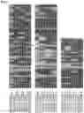 Fig. 16 - COMPOSITIONS AND METHODS FOR INHIBITING RETICULON 4