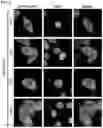 Fig. 17 - COMPOSITIONS AND METHODS FOR INHIBITING RETICULON 4