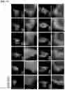Fig. 18 - COMPOSITIONS AND METHODS FOR INHIBITING RETICULON 4