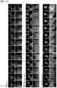 Fig. 23 - COMPOSITIONS AND METHODS FOR INHIBITING RETICULON 4